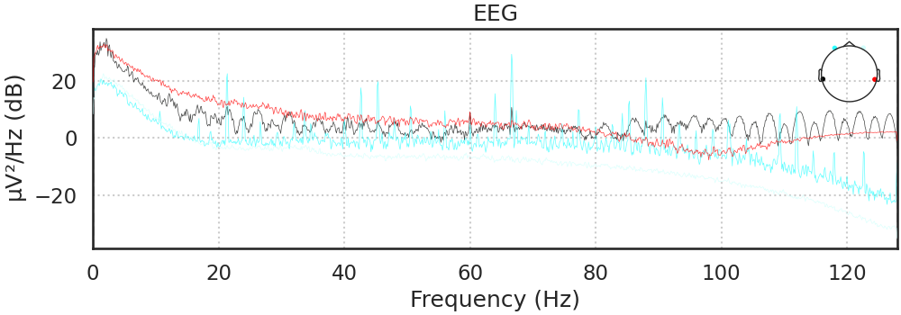 EEG