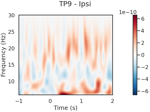 TP9 - Ipsi