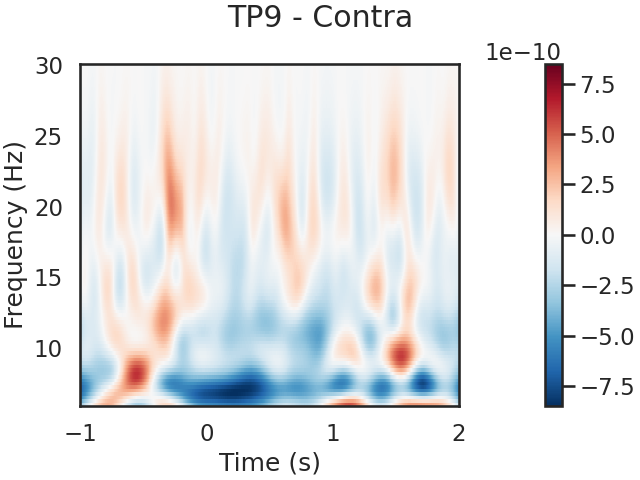 TP9 - Contra