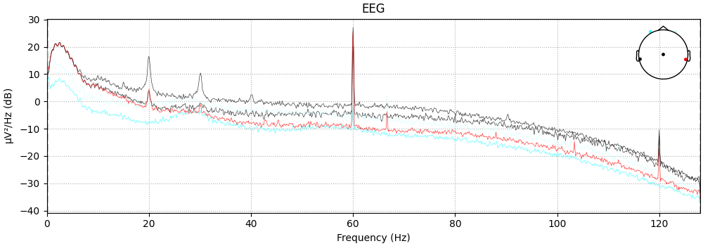 EEG