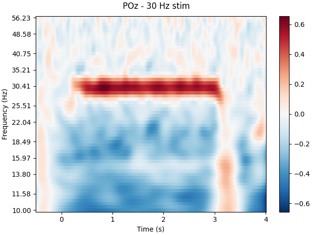 POz - 30 Hz stim