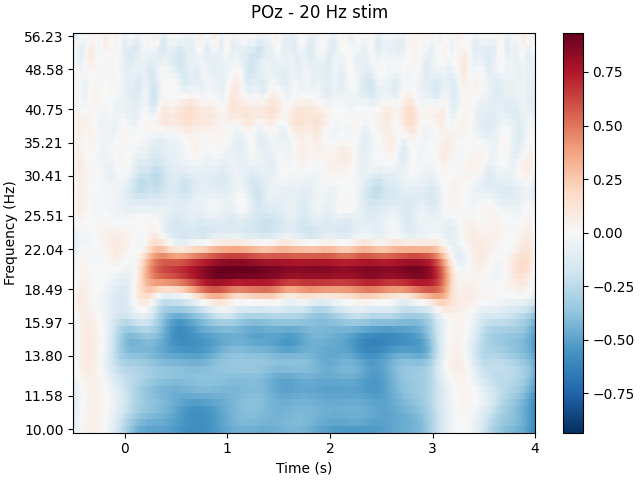 POz - 20 Hz stim