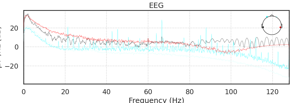 EEG