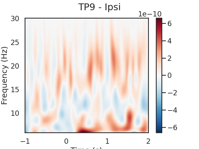 TP9 - Ipsi