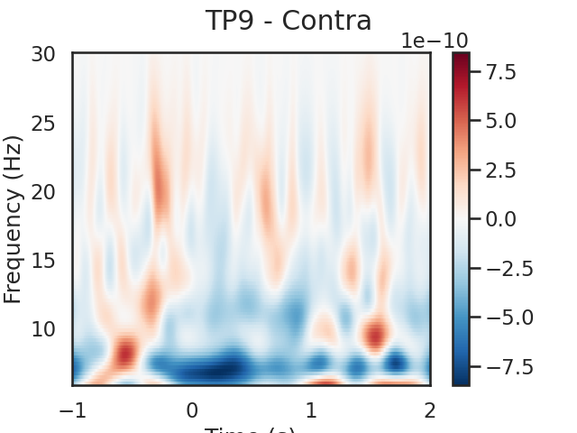 TP9 - Contra