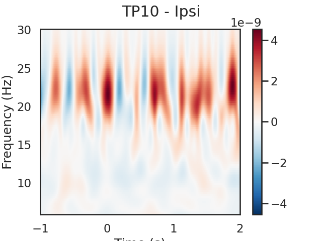 TP10 - Ipsi