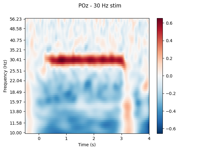 POz - 30 Hz stim